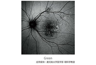 眼底自発蛍光_Green