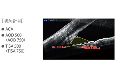 前眼部OCTアダプタ_角膜厚計測