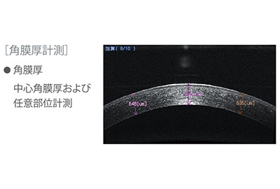 前眼部OCTアダプタ_隅角計測